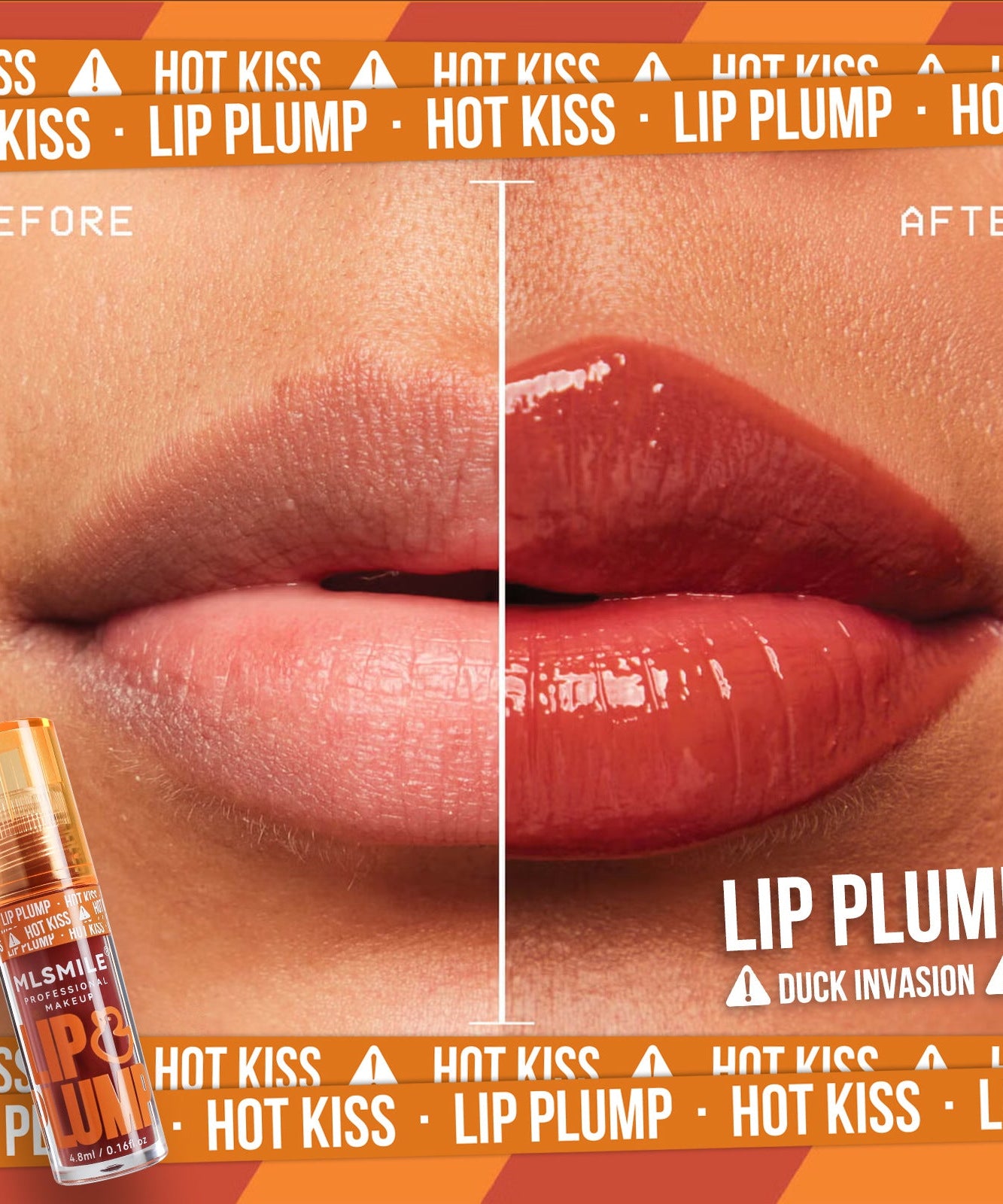 Lip Care